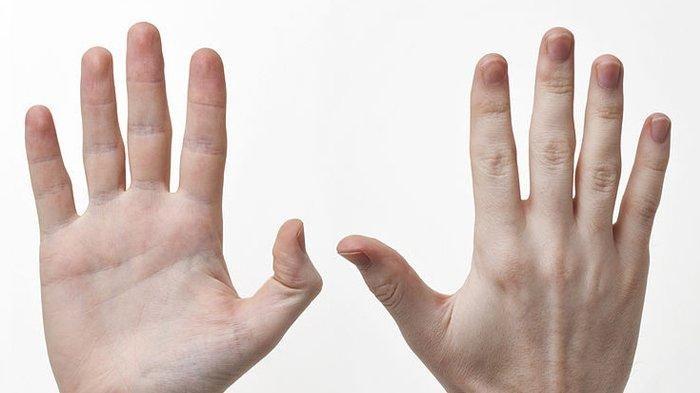 Ini Nih!!! Pertanda Gejala Kolesterol Tinggi Pada Jari Kalian